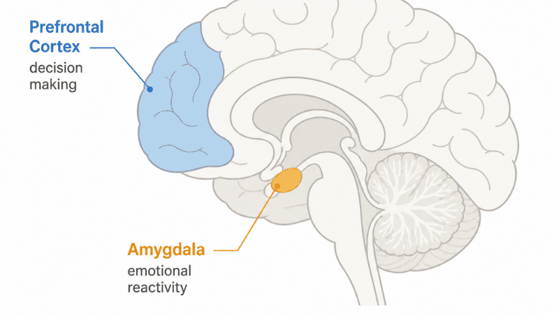 Illustration showing brain regions affected by sleep deprivation including prefrontal cortex and amygdala